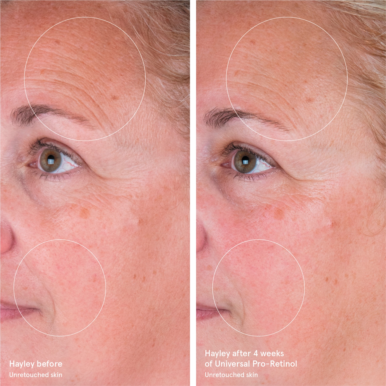 UNIVERSAL PRO-RETINOL OVERNIGHT RENEWING TREATMENT (TRATAMIENTO RENOVADOR DE NOCHE)